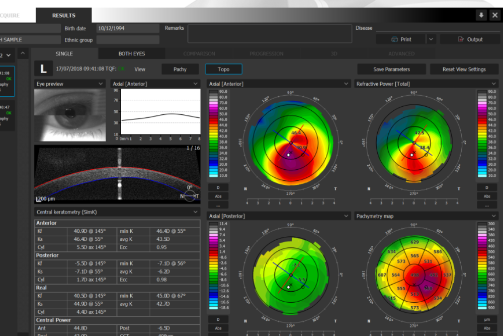 corneal-topography-mapping_strawn-and-co-eye-doctor-optometrist-west-kelowna Strawn & Co in West Kelowna use technology that provides a 200 degree view of your eyes.